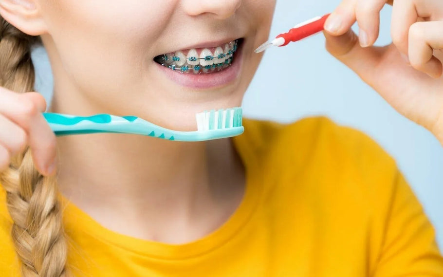 Ti puliscono i denti prima di mettere l'apparecchio e ha importanza?