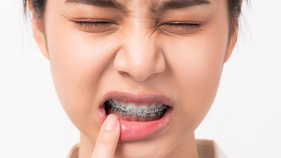 Le parentesi graffe fanno male? Cosa aspettarsi e come gestirle
