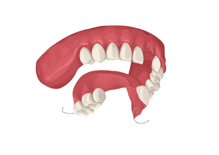 Cos'è un dente flangiato?