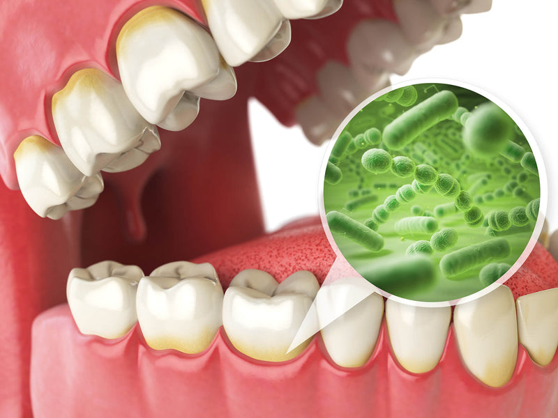 Quanto tempo ci vuole prima che un'infezione dentale uccida you?