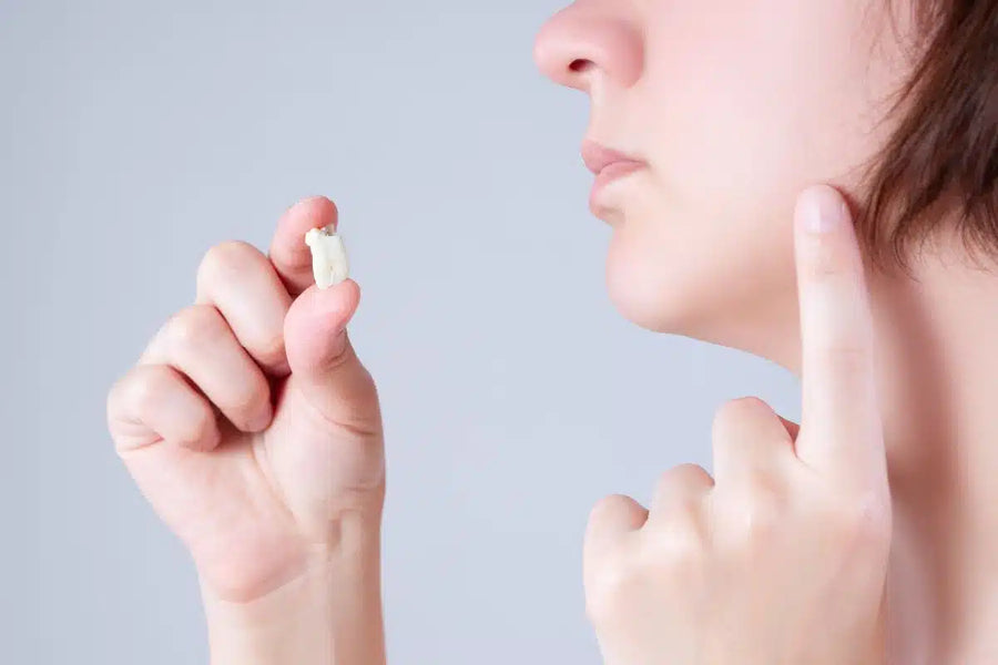 Come accelerare il recupero dei denti del giudizio