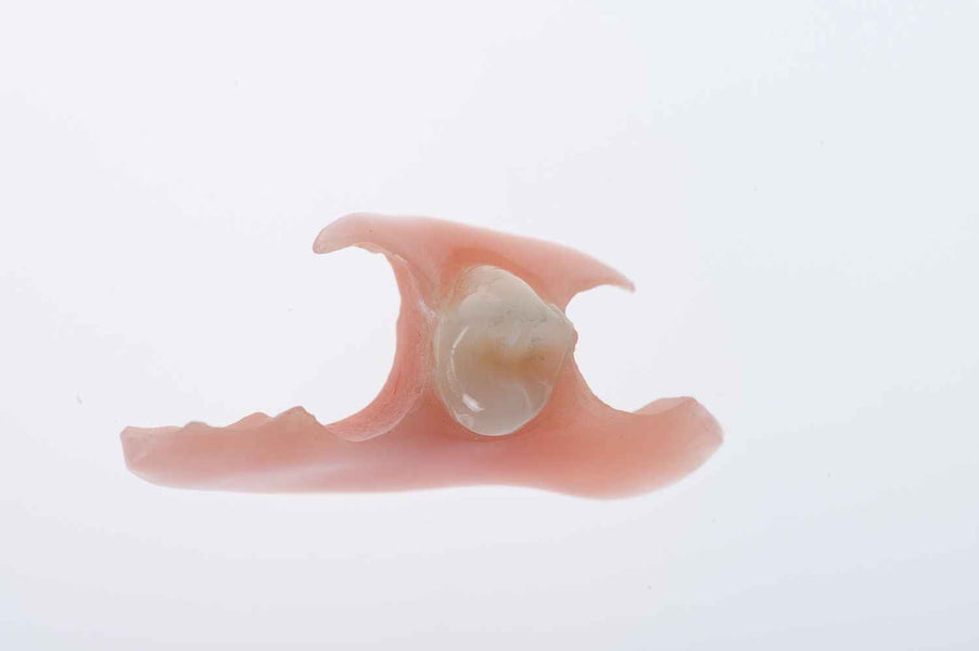 Come si fissa una protesi per un singolo dente?