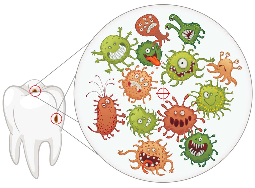Quanto tempo può rimanere non trattata un'infezione dentale?