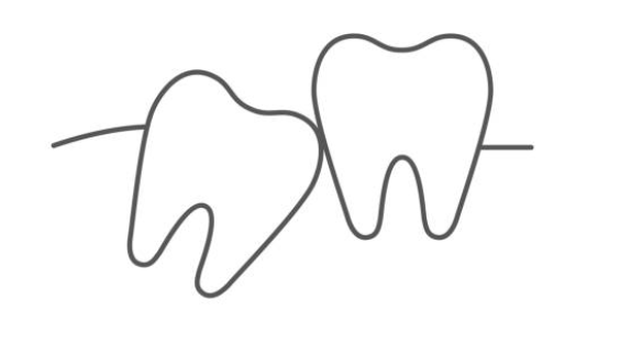 Tutti hanno i denti del giudizio?