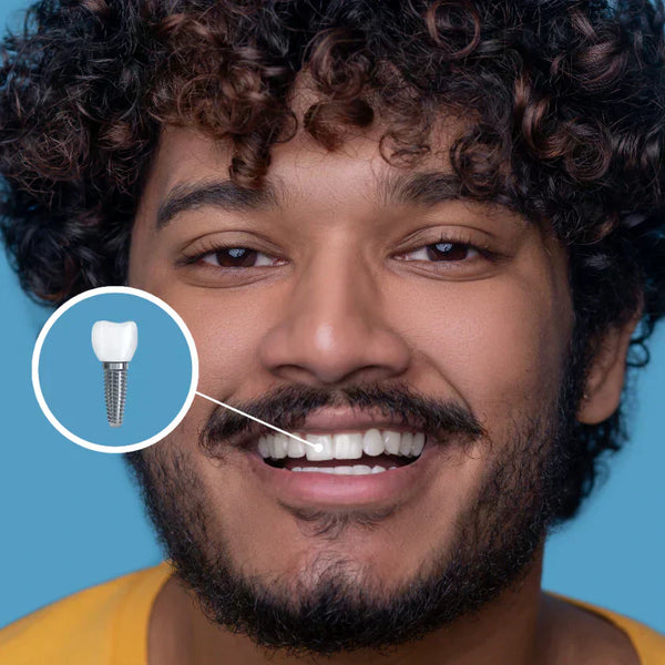 Perché evitare i latticini dopo un impianto dentale?