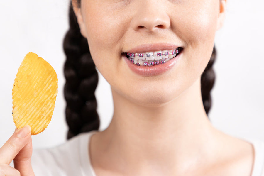 È possibile per you mangiare patatine con l'apparecchio? Consigli e Opzioni Sicure