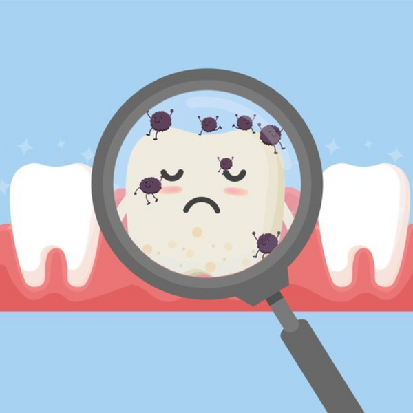 Il più potente antibiotico naturale per infezioni dentali: rimedi efficaci e prevenzione
