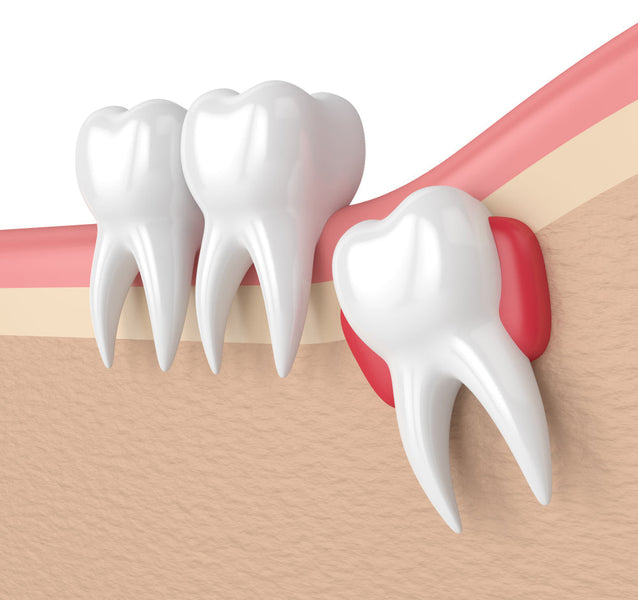 Quando spuntano i denti del giudizio?